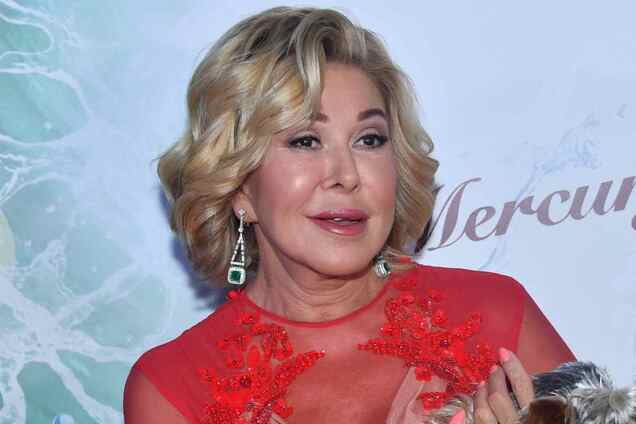 Успенская показала лицо после пластических операций