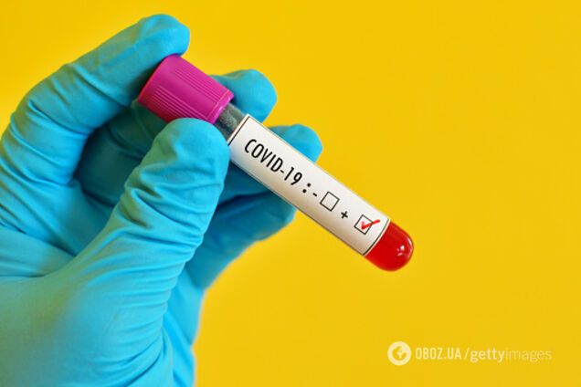 В Україні створять тест, який з одного зразка визначить грип або COVID-19