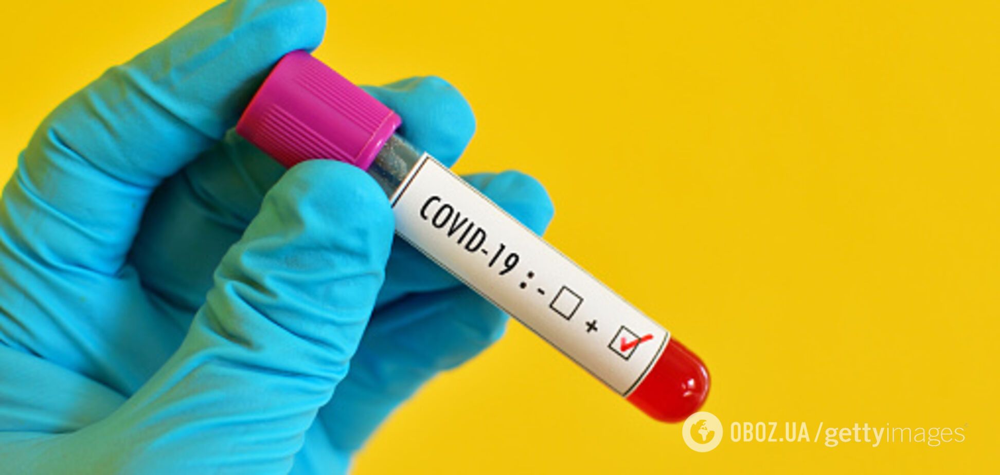 В Україні створять тест, який з одного зразка визначить грип або COVID-19