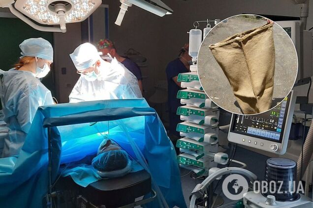 На Миколаївщині лікарі змусили жінку забрати в мішку ампутовані ноги чоловіка