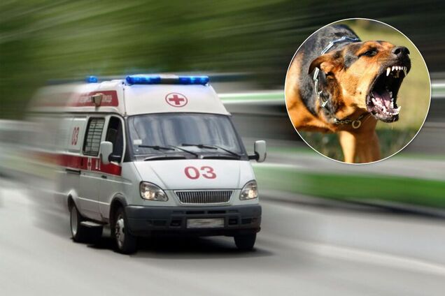 В Днепре собака искусала лицо маленькой девочки. Фото 18+