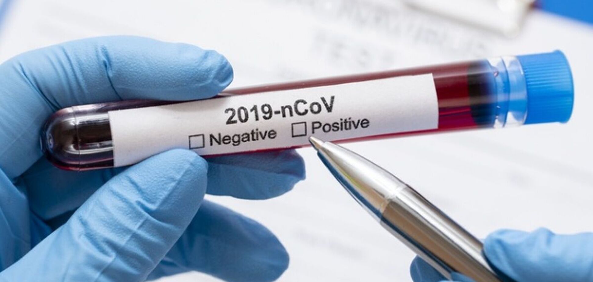 Коронавірус у Дніпрі: опублікована свіжа статистика захворюваності