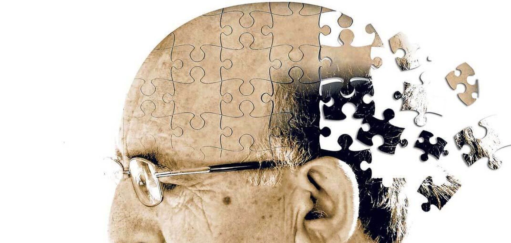 Лікарка розповіла, чому виникає хвороба Альцгеймера, і дала поради