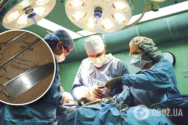 Женщине на Николаевщине отдали в мешке ампутированные ноги мужа