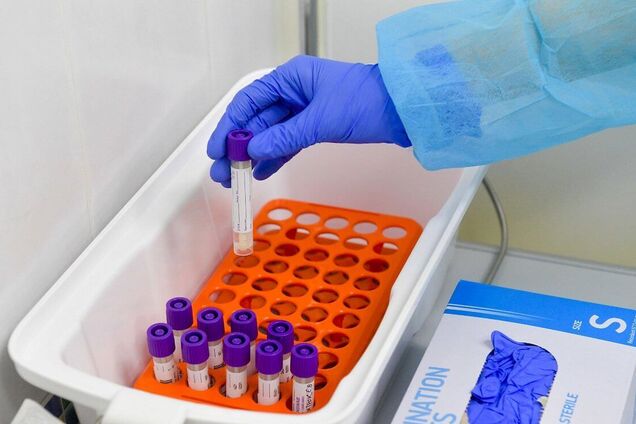 ПЛР-тести не доступні більшості українців - опитування. Фото: Фото: Рубрика