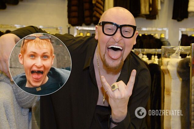 Раскрыта причина отсутствия зубов у Шуры в начале карьеры