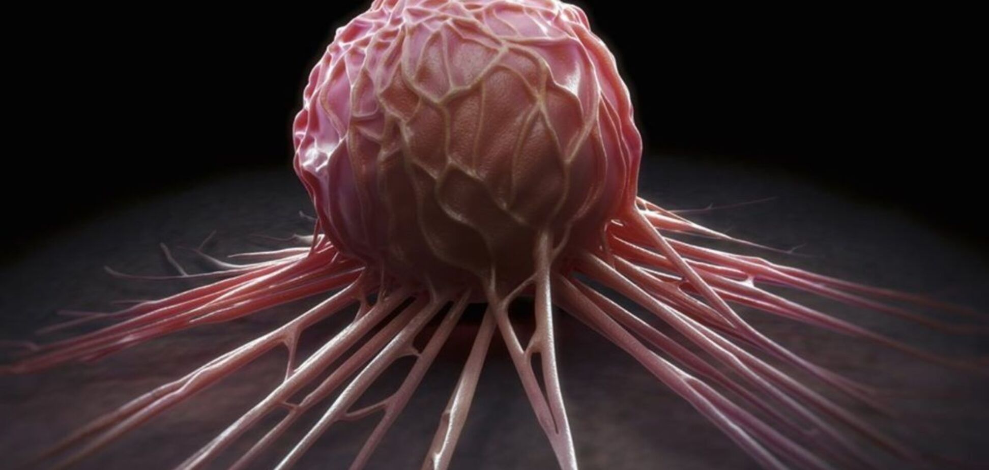 Ученые назвали способ предотвратить смертельную стадию рака