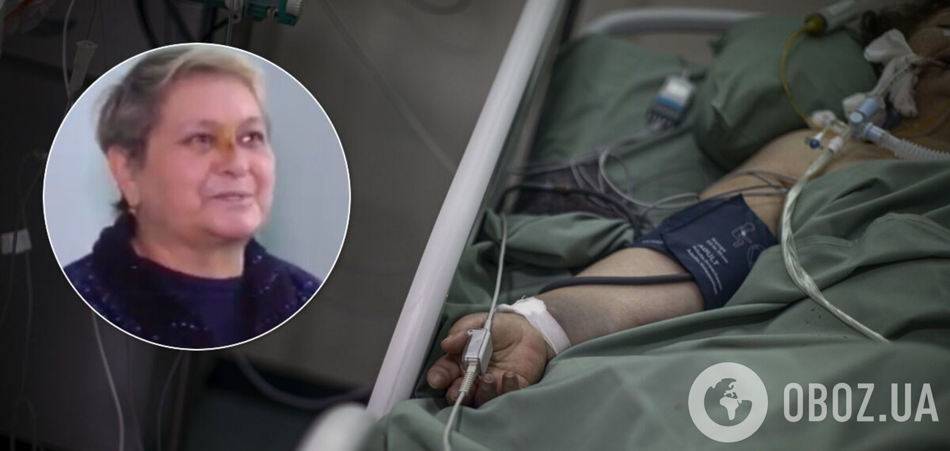 Жінка про 46 днів у реанімації: маска вросла мені в обличчя