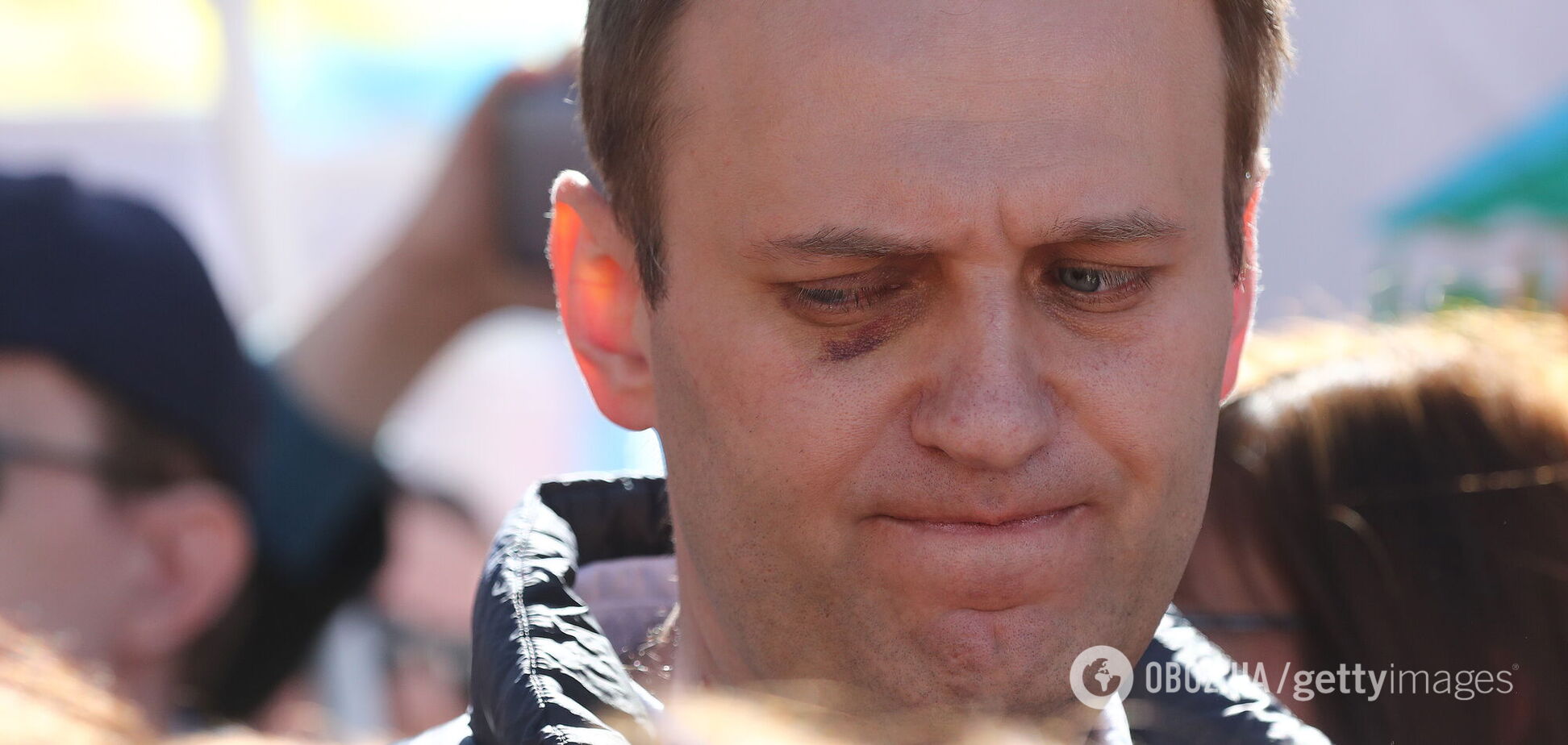 Навального допитували як потерпілого