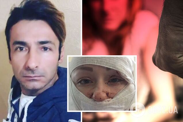 В Турции муж-ревнивец порезал лицо 27-летней украинке: подробности ЧП в аквапарке