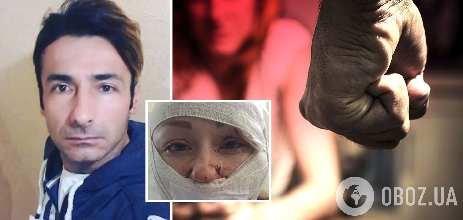 В Турции муж-ревнивец порезал лицо 27-летней украинке: подробности ЧП в аквапарке