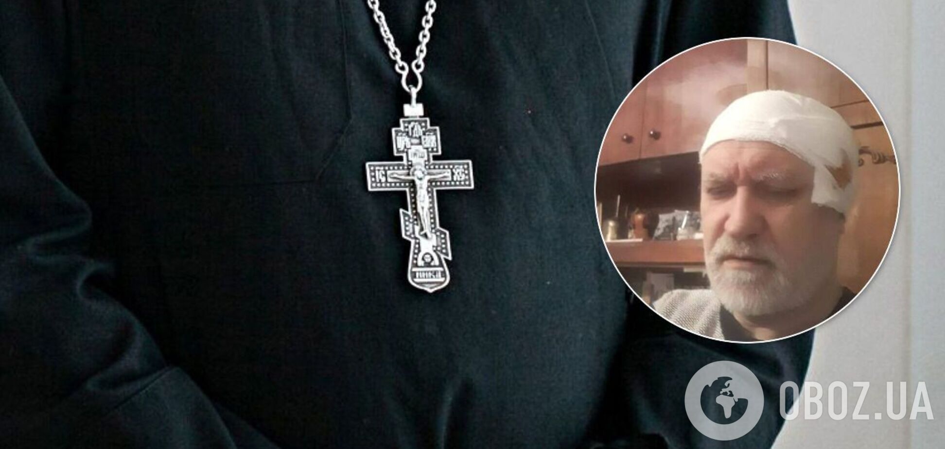 Пострадавшего священника прооперировали