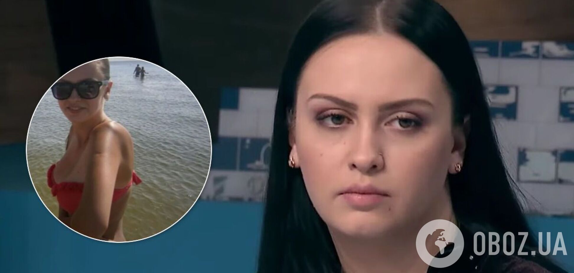 22-летняя украинка решила избавиться от 7-го размера груди