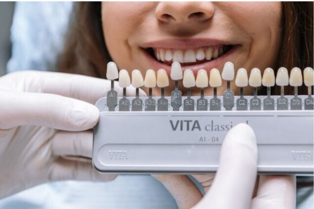 Сияющая улыбка: профессиональное отбеливание зубов