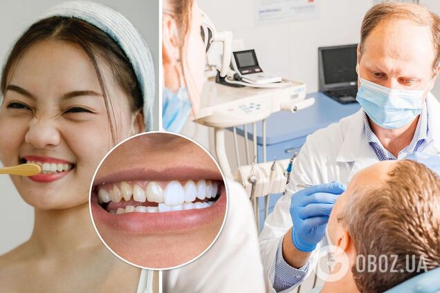 Виниры или свои зубы: стоматолог назвал плюсы и минусы голливудской улыбки