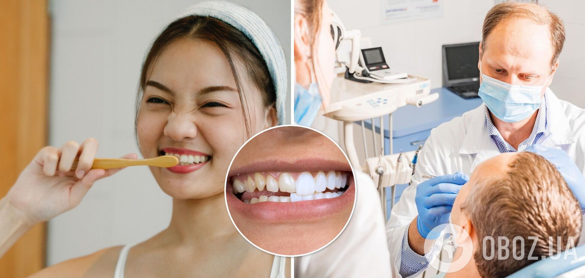 Виниры или свои зубы: стоматолог назвал плюсы и минусы голливудской улыбки
