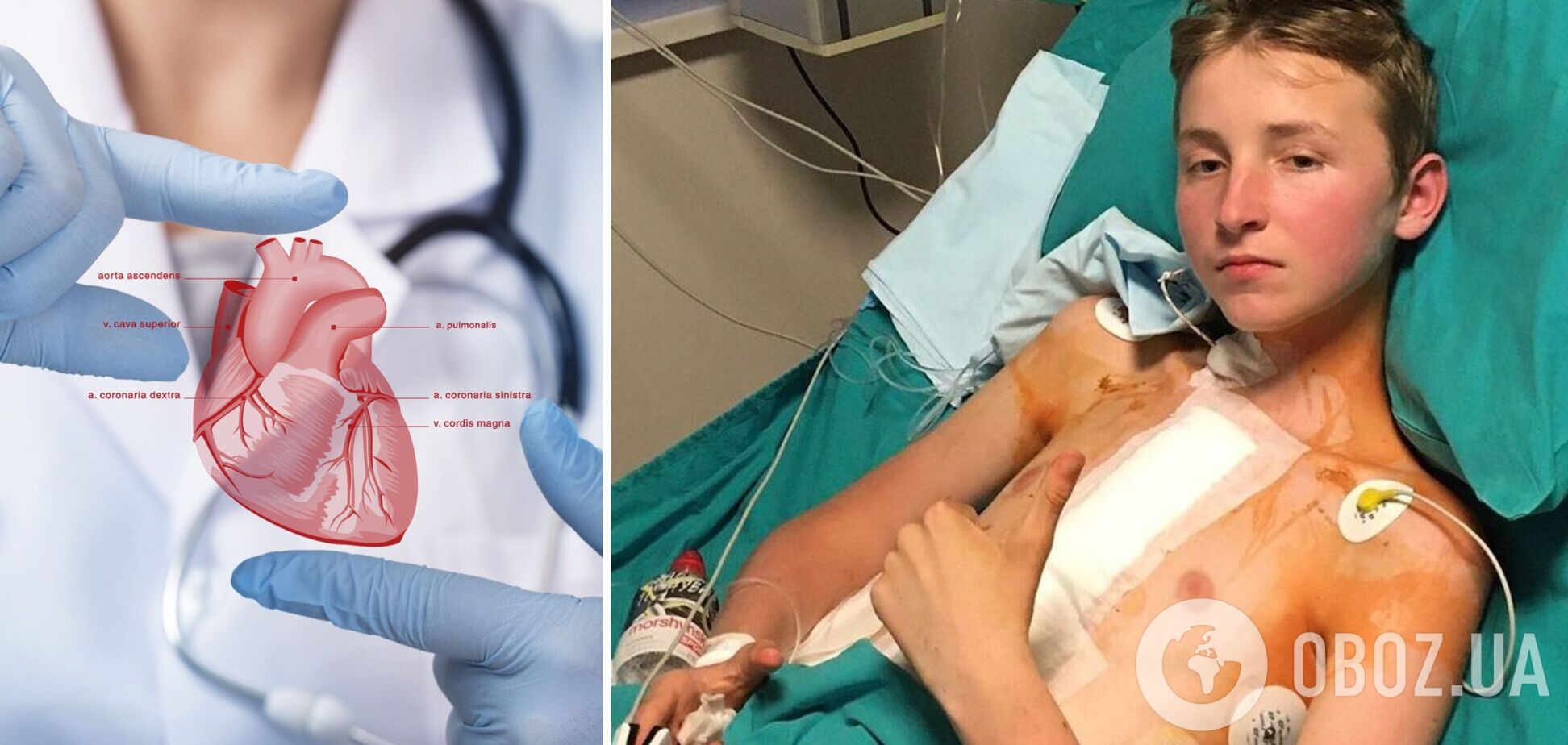 13-річний підліток, якому вперше в Україні пересадили серце, про свій стан: дихати легше. Фото