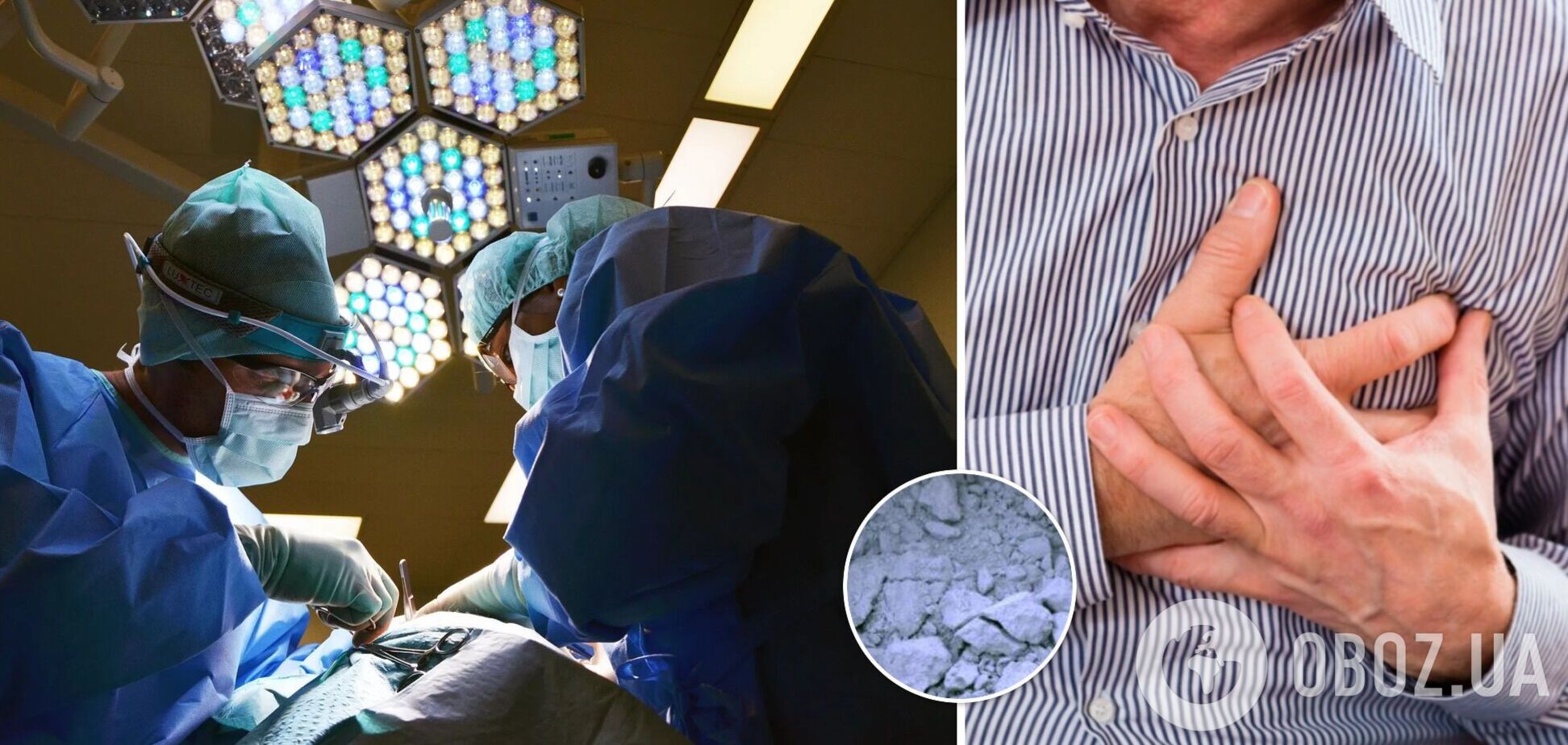 Лікарі знайшли в серці чоловіка шматок цементу: з'ясувалося, що трапилося