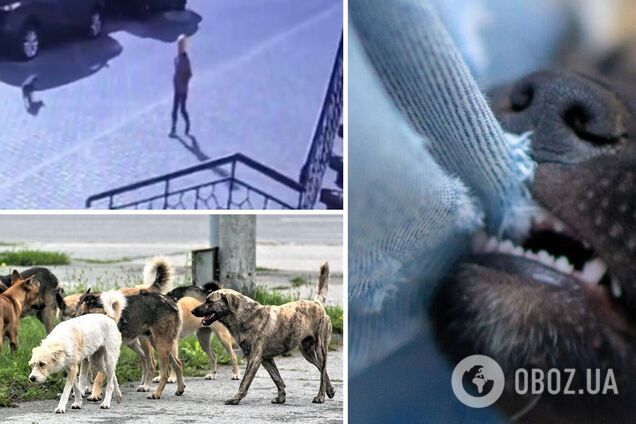 В Одессе стая собак напала на 8-летнего ребенка: появились данные о его состоянии. Видео