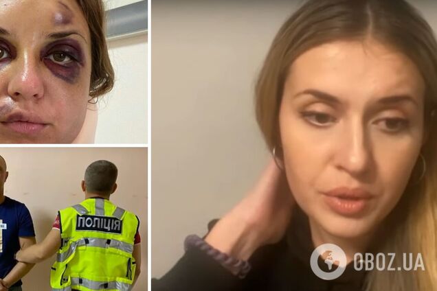 Побита в поїзді телеведуча розповіла, яку компенсацію отримає від 'Укрзалізниці': просила іншу суму