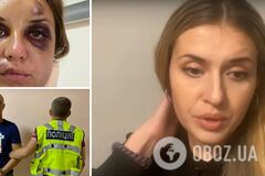 Побита в поїзді телеведуча розповіла, яку компенсацію отримає від 'Укрзалізниці': просила іншу суму