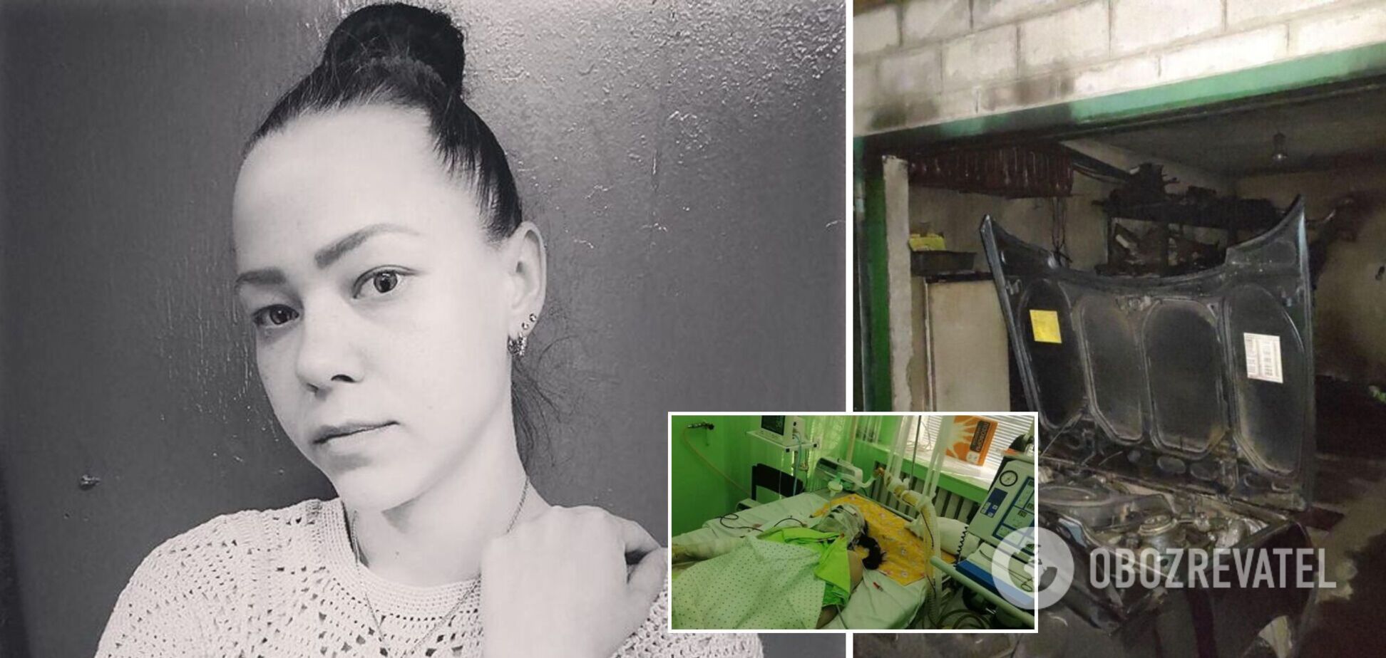 В запорожской больнице умерла женщина, которую в гараже поджег муж. Фото