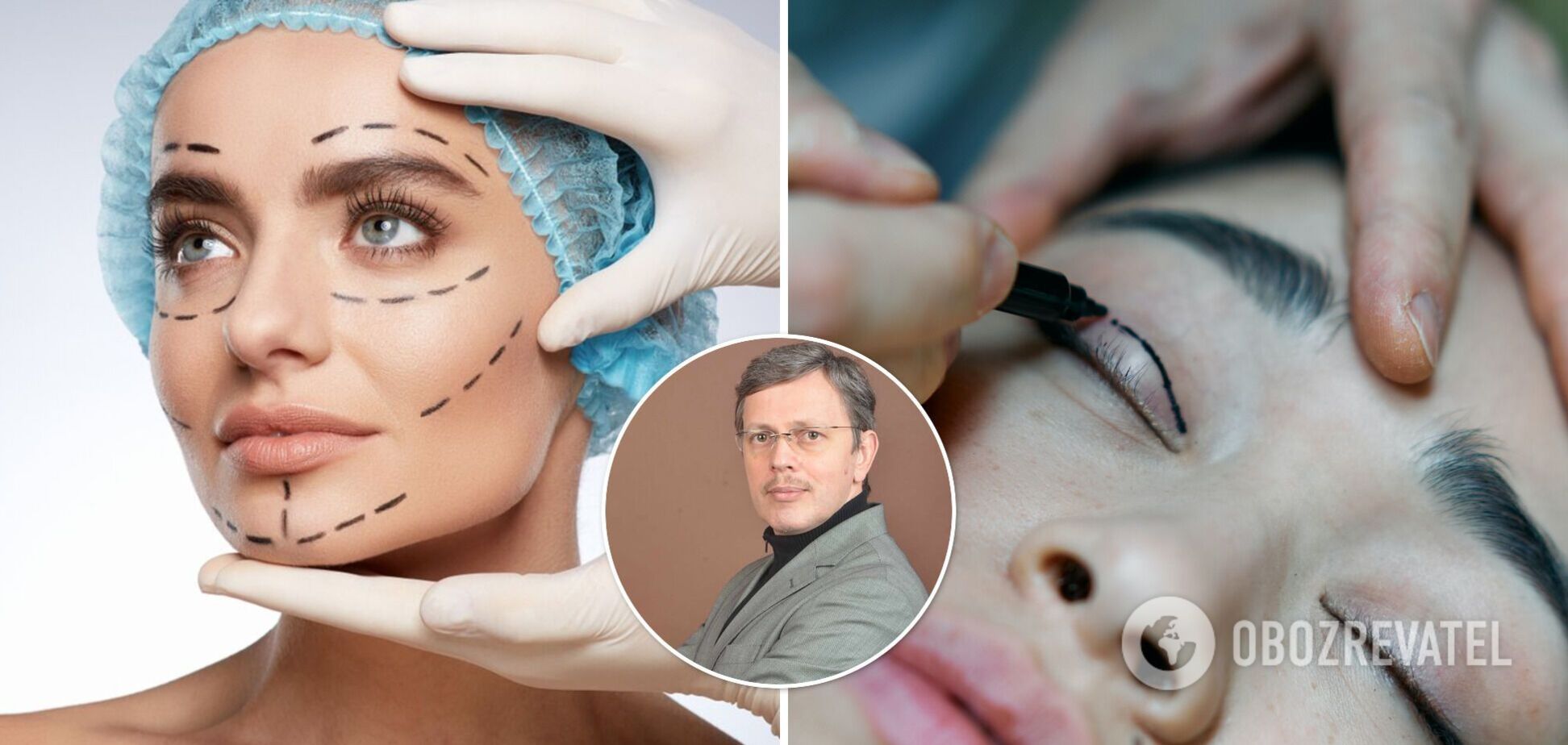 'Комплекс чебурашки' та ніс кривий: пластичний хірург назвав топ-5 найпопулярніших операцій в Україні. Ексклюзив