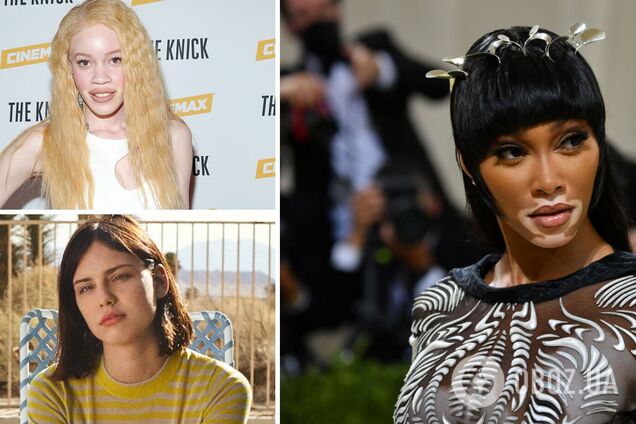 5 моделей, которые разрушили стереотипы о стандартах красоты. Фото