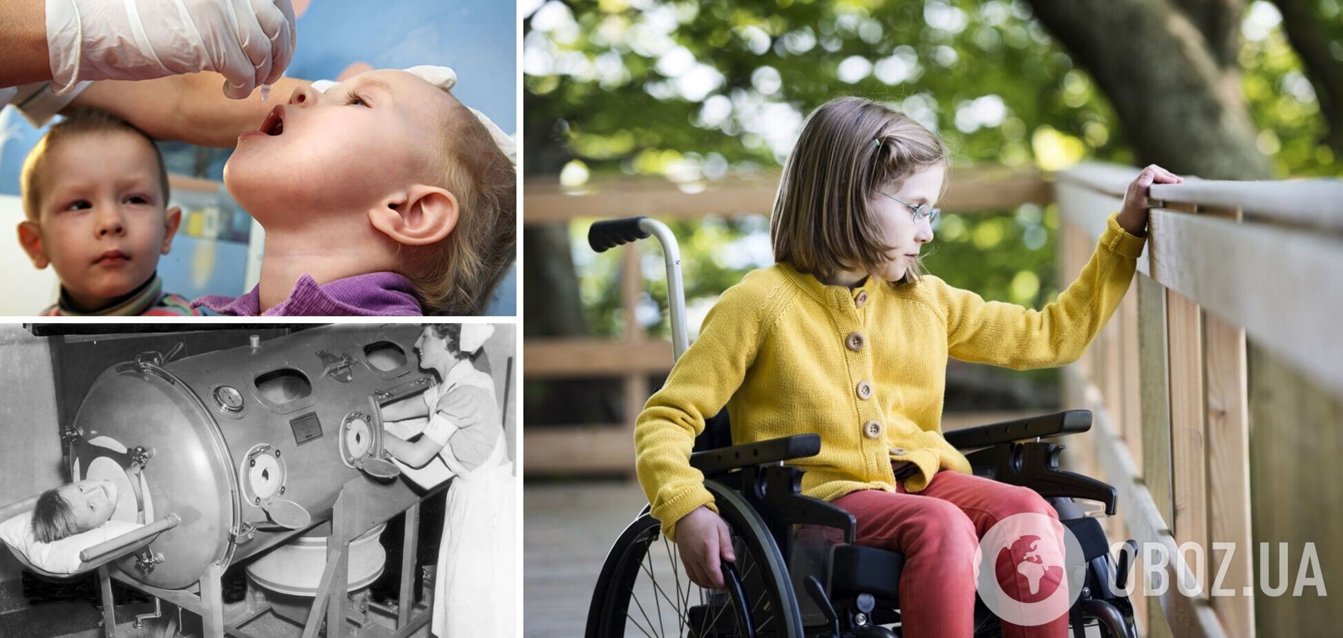 В Украине опять начали фиксировать случаи заражения полиомиелитом