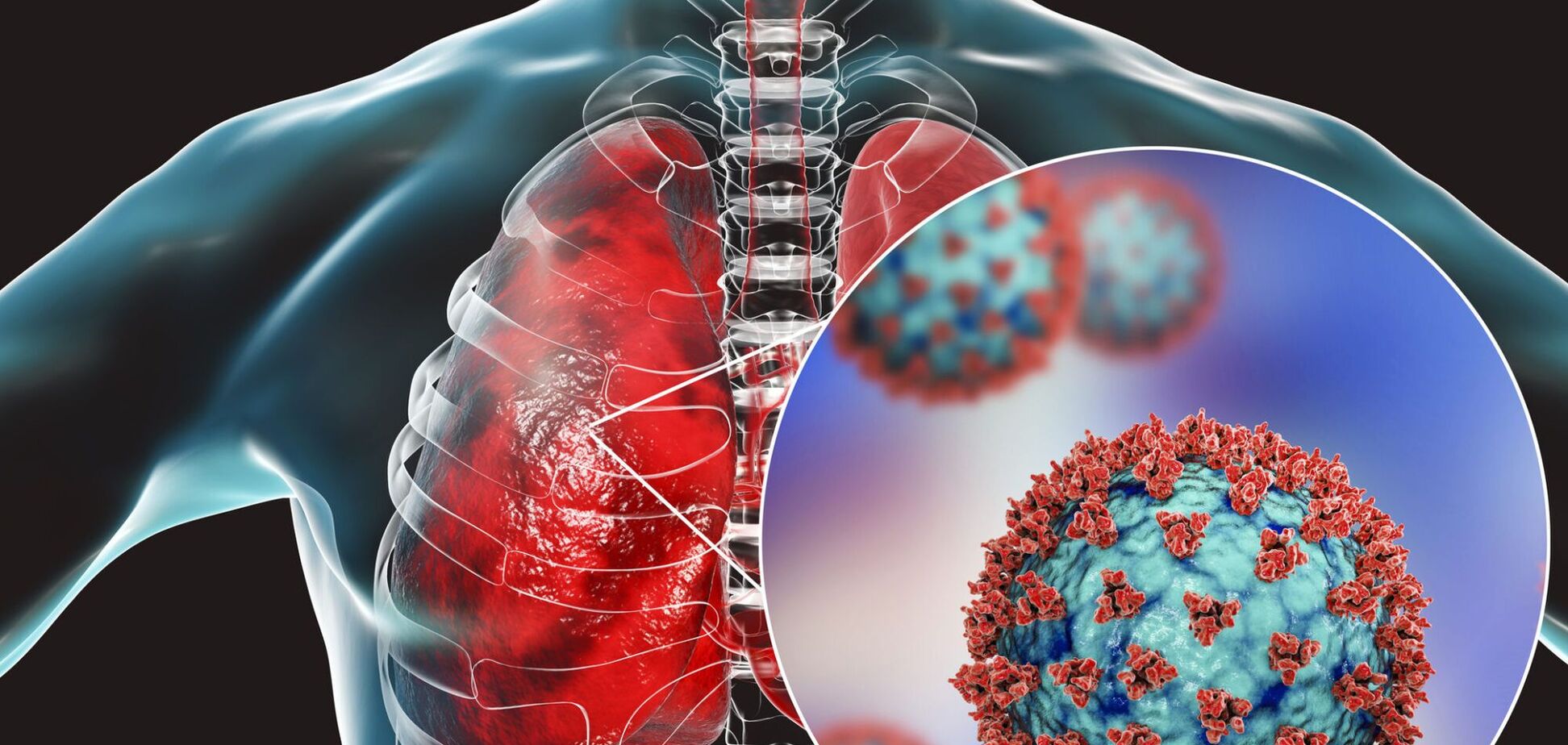 Влияние COVID-19 на дыхательные пути: как избежать острого поражения легких