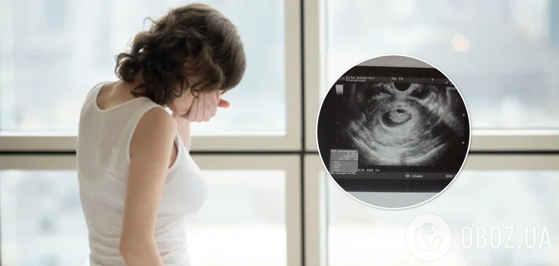 В Канаде зафиксировали необычный случай внематочной беременности: ребенок развивался в печени