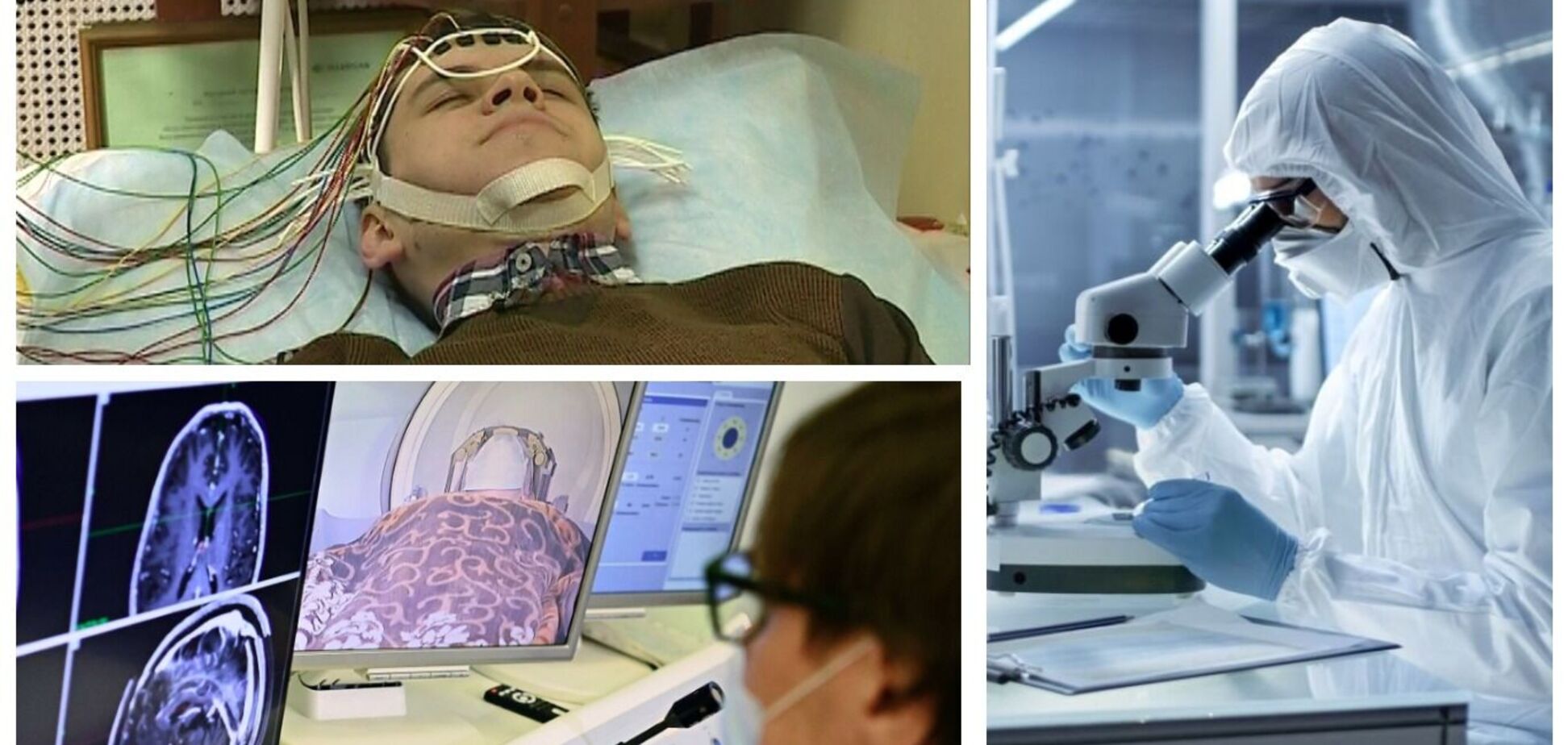 Ученые оценили риск инсульта у госпитализированных с COVID-19 и рассказали, кому грозят осложнения