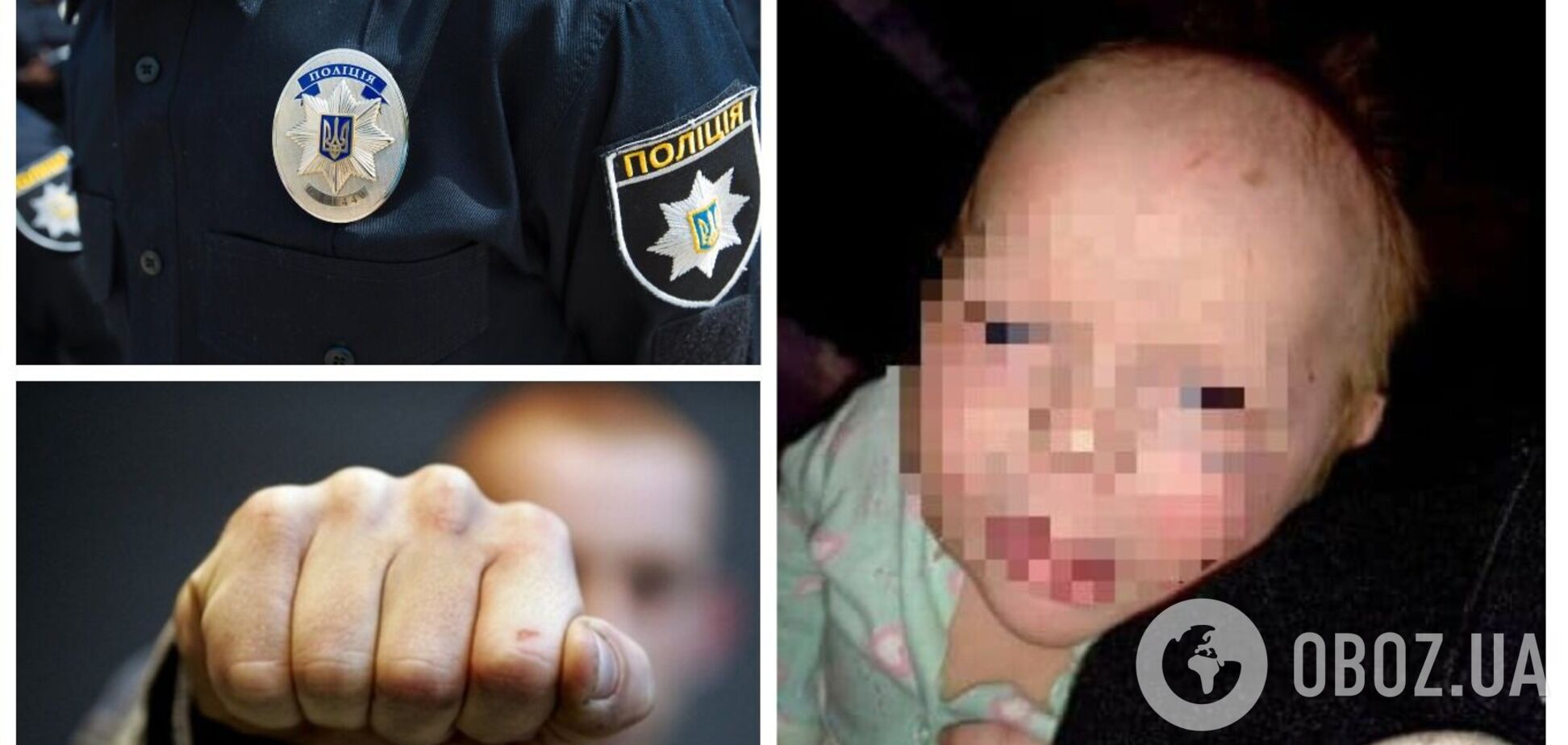 На Вінниччині п'яний батько побив немовля: дитина потрапила до лікарні зі струсом мозку. Фото