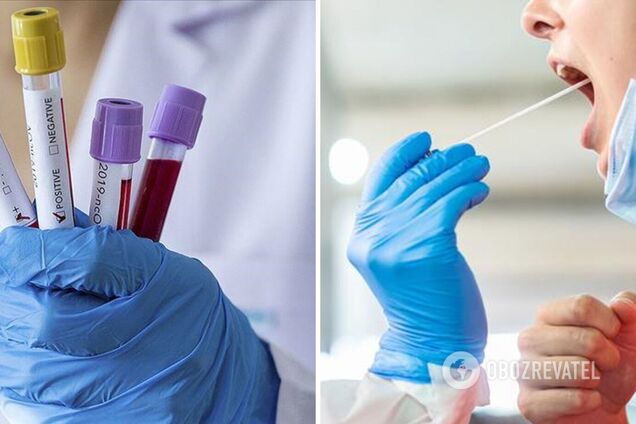 Итальянцы устроили ажиотаж с ПЦР-тестами на коронавирус