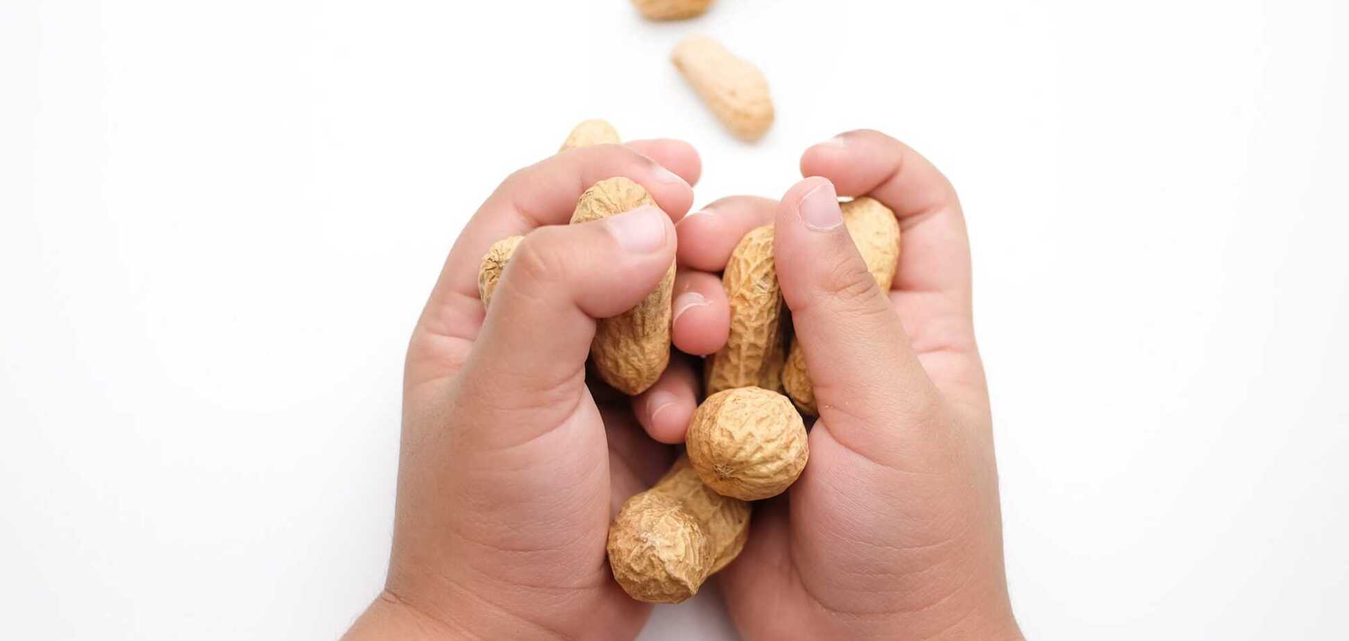 Вчені знайшли причину харчової алергії у дітей