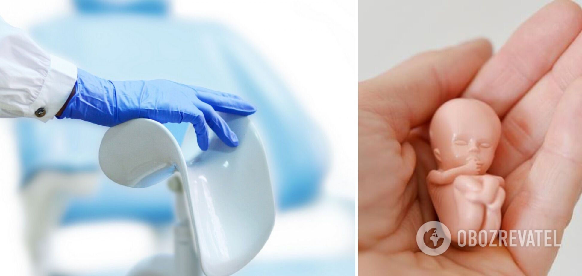 У гинеколога диагностировали легкие телесные повреждения