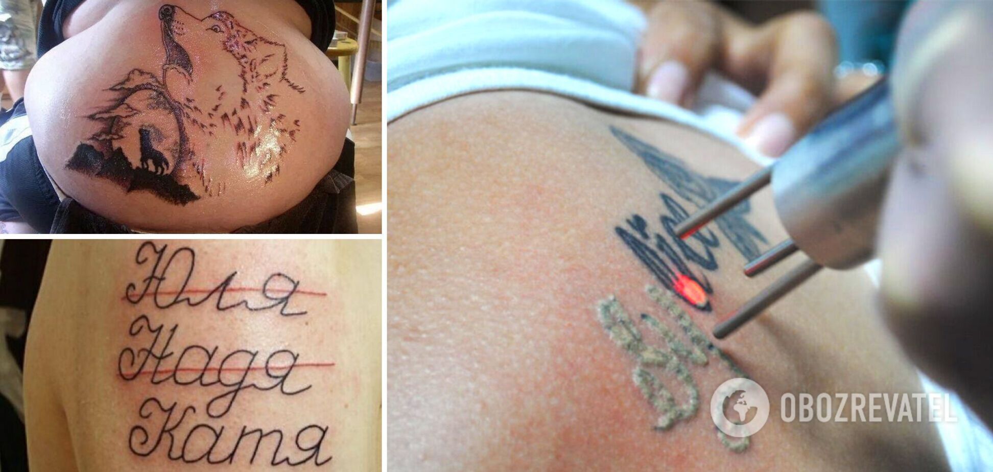 Неудачные татуировки, которые нужно будет удалять