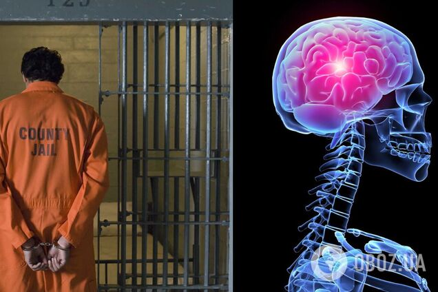 Изучен мозг психопатов в тюрьмах: опубликованы результаты