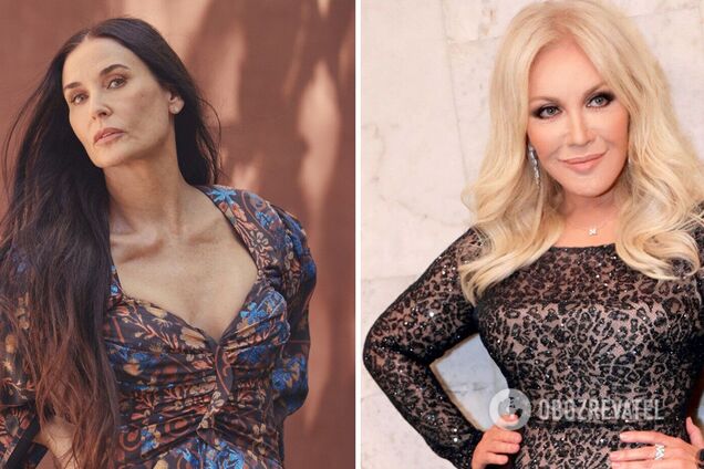 Звезды, которые стали жертвами пластической хирургии: фото до и после операций