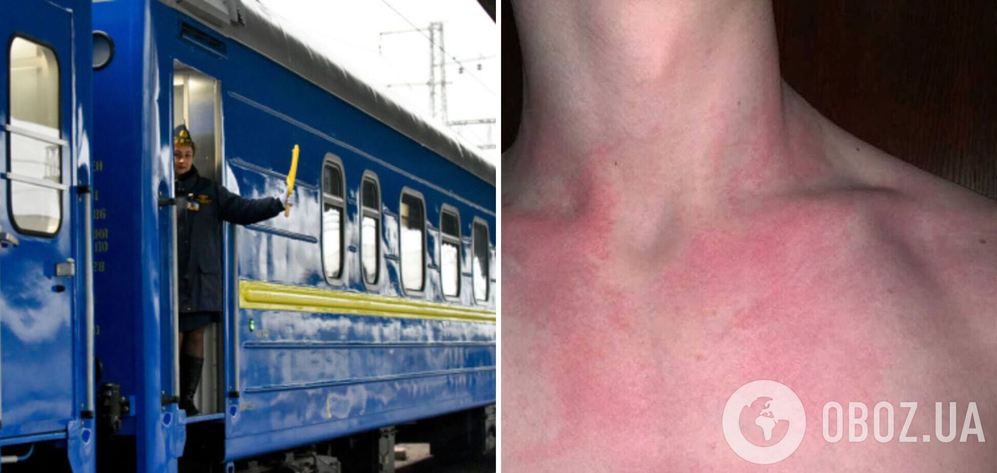 Пассажиры 'Укрзалізниці' пожаловались на нападение клопов