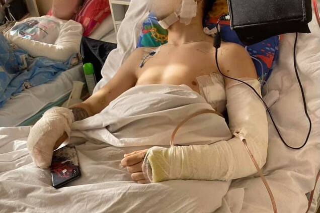 Поранені в госпіталі, багато з ампутацією: потрібна допомога