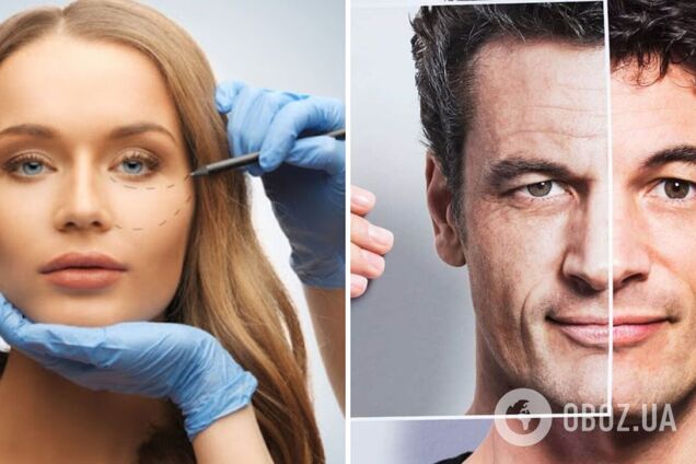 Лисьи глазки и змеиный язык: самые трешевые запросы пластическому хирургу