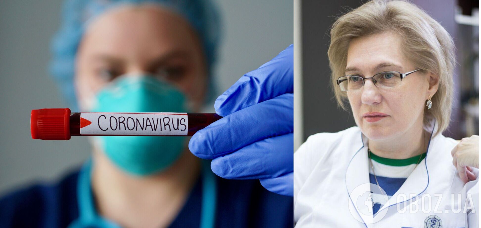Голубовская назвала самые распространенные осложнения коронавируса
