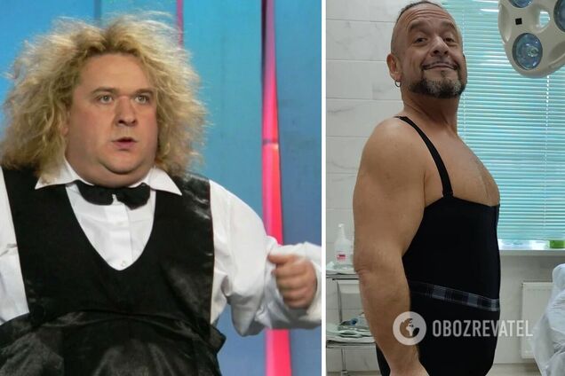 Зірка 'Кривого дзеркала' показав, який вигляд має після пластики. Фото