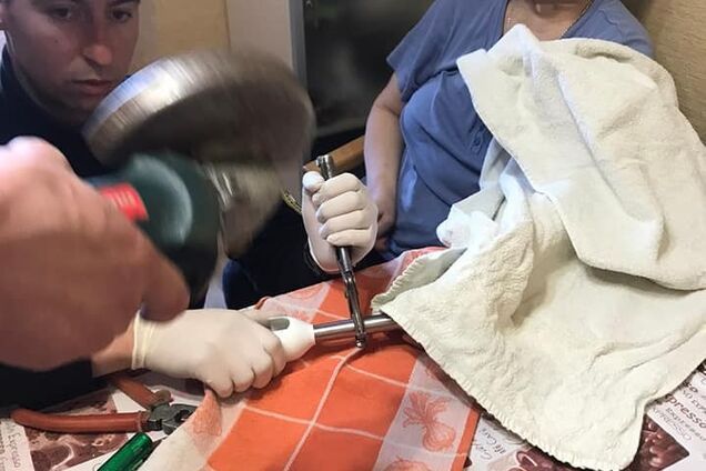 В Киеве женщина засунула пальцы в работающий блендер. Фото