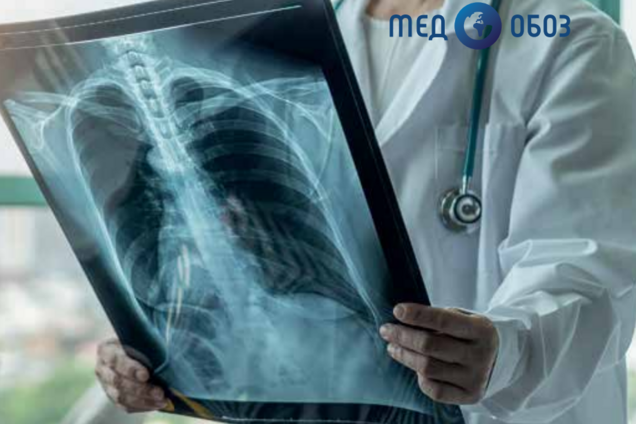 Как флавоноиды влияют на коронавирус SARS-CoV-2: зарубежные исследования