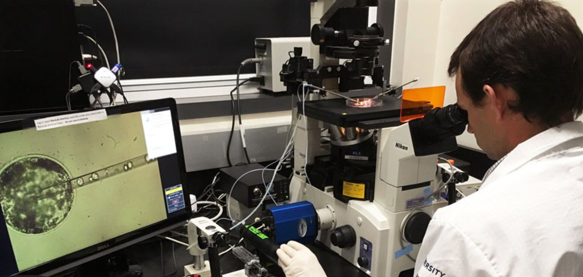 Ученые вырастили человеческие клетки в эмбрионе макаки