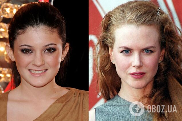 Вы их не узнаете: как выглядели до славы Кайли Дженнер, Николь Кидман и другие звезды