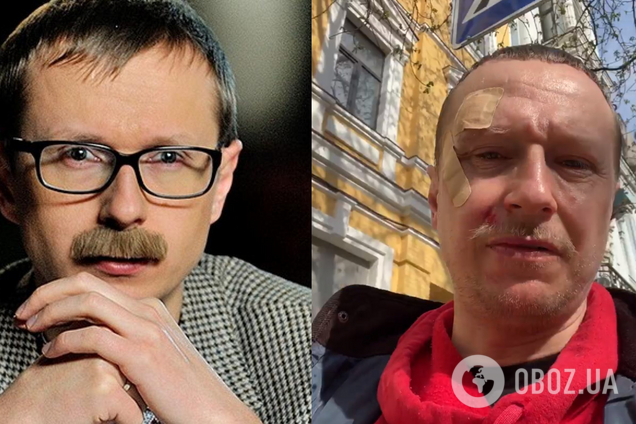 В Киеве избили ведущего 'Телебачення Торонто' Майкла Щура. Видео
