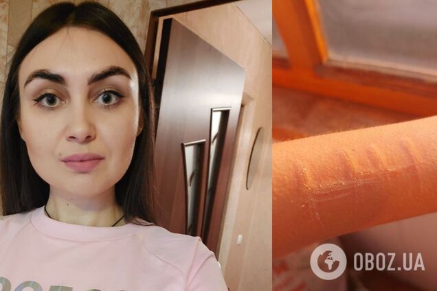 В России неизвестные похитили и жестко пытали координатора штаба Навального. Фото